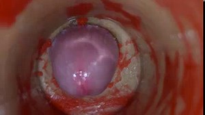 Insemination - Internal Camera Captures Deep Male Ejaculation