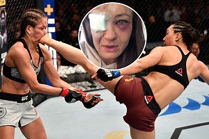 UFC star Kowalkiewicz left with broken eye socket and patch after brutal kick to face