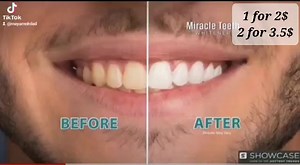 *Miracle Teeth 醴 WHITENER* علبة 20 غرام *مبيض الفحم الفوري...