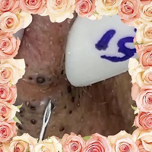 9.9K views · 138 reactions | My Favorite Watch ❤️ | Alone | Facebook