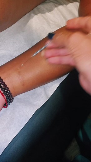 AmityvilleAcu & Microneedling on TikTok