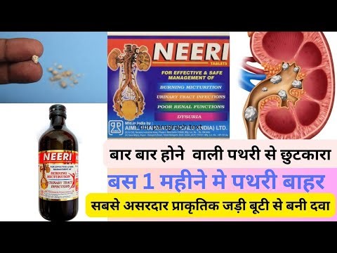 NEERI syrup || पित की थैली की पथरी || किडनी की पथरी || Ureter Stone || #kidneystone #neerisyrup