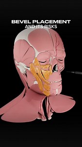 19K views · 75 reactions | Piriform Fossa - Why Bevel Orientation...