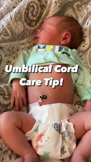 924K views · 7.5K reactions | Umbilical cord care tips  #pregnancy#pregnant #babytips | Pregnancy | Facebook
