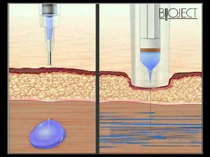 Biojector B2000 video - YouTube