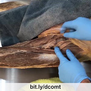 Femoral Nerve, Artery, and Vein. 👍👍👍 . This video clip is from a longer more thorough video lesson on LearnMuscles Continuing Education (LMCE), my video streaming subscription service for manual therapists and movement professionals. 🌟🌟 . Following with cadaver anatomy of the hip... here we see the neurovascular bundle composed of the femoral nerve, artery, and vein in the femoral triangle of the proximal anterior thigh. 👍👍 . The femoral nerve provides motor innervation to the musculature