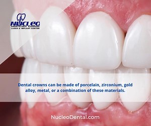 A dental crown is a cap placed over a tooth to restore shape, size, and strength. Contact us and learn more about our dental crown service. . Phone: 915 308 0101 nucleodental.com . #NucleoDental #dentalclinicnearme #dentaltourismmexico #dentalimplantsjuarez #bestdentalserviceintown #dentalservice #elpasotexas | Nucleo Dental | Facebook