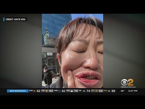 NYPD: Suspect Attacked Mother Who Attended Rally Against Racial Violence