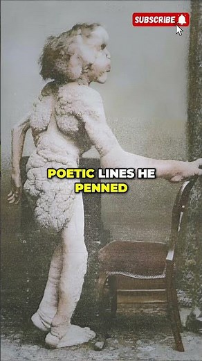 "Elephant Man - The Untold Story of John Merrick's Life" - 1862-1890