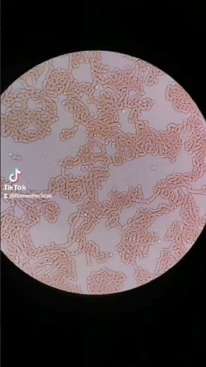 Blood under the microscope #microscope #medtechstudent #blood #medtech #rmt #cls