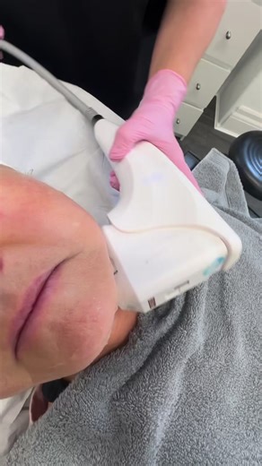 3.3K views | High-Intensity Focused Ultrasound (HIFU) offers numerous...