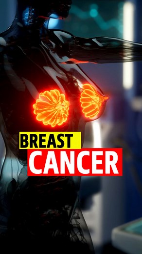 42K views · 319 reactions | Breast cancer.. #health #science #medical #biology #research #learning #reels #cancer #breastcancer | Doctor ASKY | Facebook