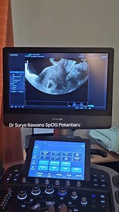 98K views · 1.2K reactions | semangat pejuang garis dua promil sungguh mudah bagi Allah #dokterkandunganpekanbaru #pejuanggarisdua #kitapunyaALLAH | Dr Suryo Bawono SPOG | Facebook