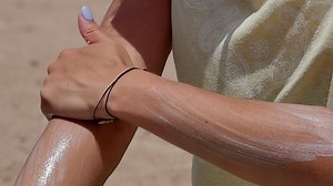 What is Merkel cell carcinoma?