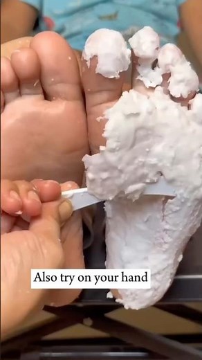 Repair Cracked Heels With Candle/ Get Rid Cracked Feet| Fair Feet Bleach #pedicure #shorts #beauty