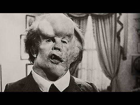 The Elephant Man (1980) Movie Recap | Psychological Drama Mystery