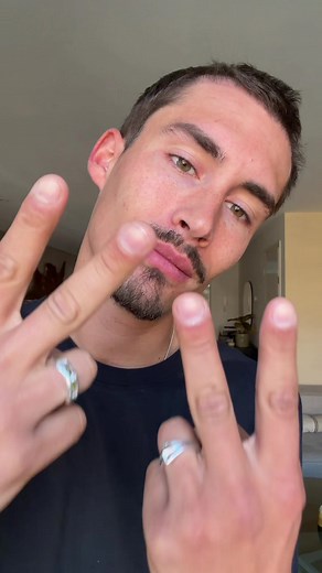 3 maanden update - ECHT ik ben door zoveel fases heen gegaan. Eerste weken rocking de baldy look was mega echter rond week 4-6 krijg je te maken met shockloss waarbij de nieuwe bijgezette haren uitvallen. Taaie periode maar gelukkig beginnen vanaf maand 2,5 de nieuwe haren langzaam te groeien. Disclaimer: ik heb hier goed en lang over nagedacht, neem niks van mij aan. Ik wilde met deze serie laten zien waar je aan toe bent als je dit aangaat. Ik heb deze operatie bij @Alpha Haarkliniek gedaa & h