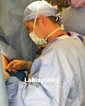 Labiaplasty with Dr. Courtney