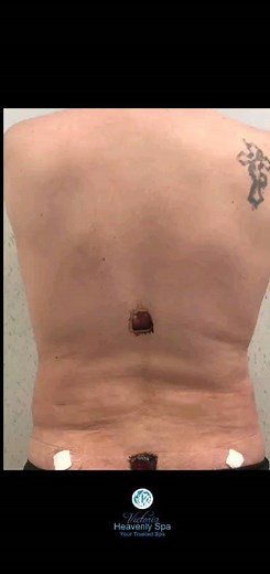 2.4K views | Call us at 832-380-0696 ☎️ #lymphaticdrainagemassagehouston #bestlymphaticmassagehouston #liposuctionhouston | Victoria Heavenly Spa | Facebook