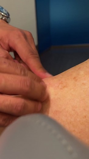 Shoulder Lipoma Removal Part 1