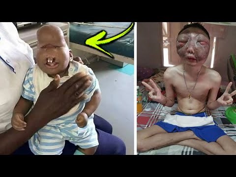 10 Unusual & Amazing People Around The World You Won't Believe Exist