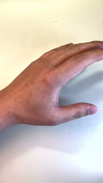 4 Easy Acupressure Points to Help Suppress the Gag Reflux #shorts ‪@fauquierent‬