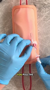Here’s why your cannulas might be Kinking! 🩸💉 #medstudent #nursingstudent #medicine #howtotiktok