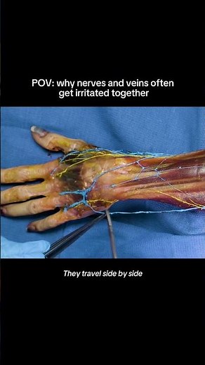 Why nerves and veins often get irritated together.