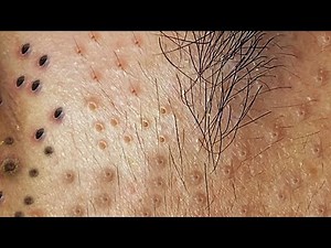 Satisfying Relaxing with Best Video 2021 Windy Spa #010