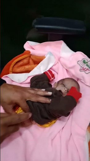 hip joint dislocation