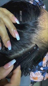 Satisfying Dandruff Removal With Comb Big Flakes | Keo Tube