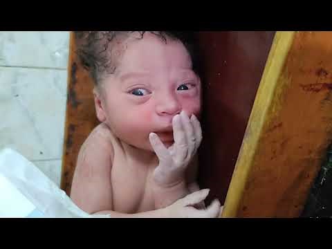 Poor Newborn Baby after delivery immediately first cry #birth #love #delivery #angel #cute #baby