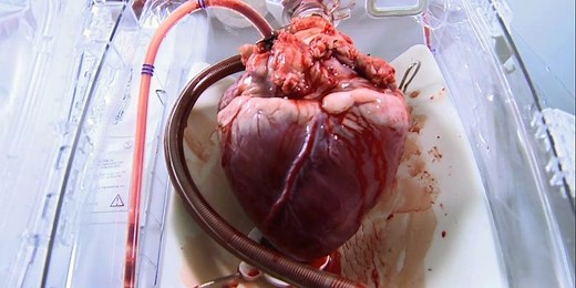 This machine keeps a heart beating long after it has been removed from a body