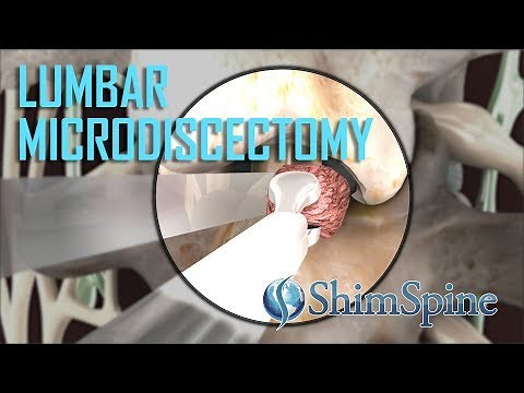 Lumbar Microdiscectomy
