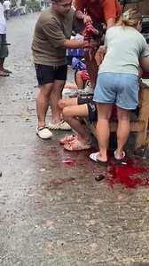 Hand Blown Off With Fireworks