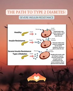 Did you know that you can still have insulin resistance, even if you have a normal blood sugar? 😟 In fact, for most people with insulin resistance, their blood sugar initially remains normal for years or decades before it starts to rise. ⬆️ Insulin resistance is the root cause of type 2 diabetes and prediabetes, but it is not until the insulin resistance is severe (and the pancreas cannot keep up with the increased demand for insulin) that your blood sugar rises. This is why just checking a blo