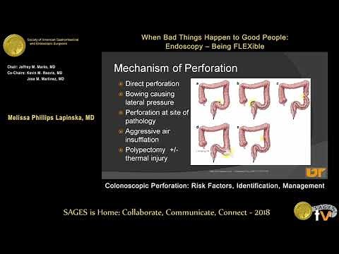 Colonoscopic perforation: Risk factors, identification, management