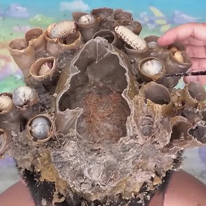 Dry Itchy Scalp Satisfying Removal A Lot Worms From Dandruff Hole #2051 Part 13 | Help remove ticks