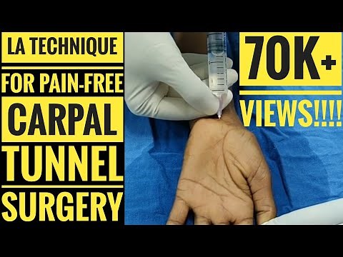 Local Anaesthetic Injection Technique for Pain Free Carpal Tunnel Decompression Surgery