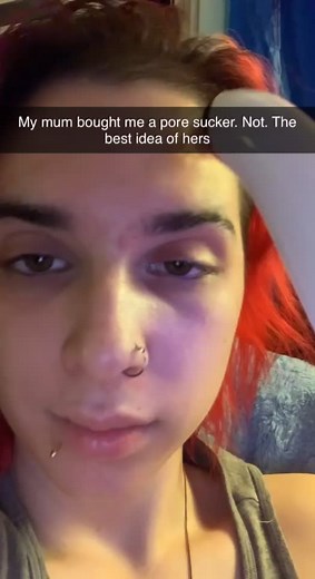 Effective Blackhead Removal Techniques with Pore Cleaner Tools