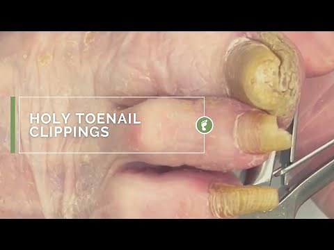 HOLY TOENAIL CLIPPINGS
