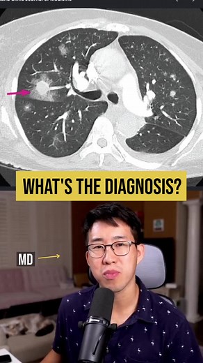 50-year-old coughing up blood: causes, diagnosis, next steps