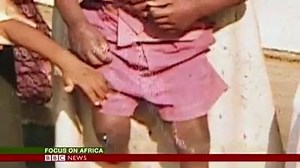 BBC/ -Zimbabwe's breakdance king who uses a wheelchair* When Zimbabwean Blessing Bboychristyles Bfire was born, he was told by doctors he would never be able to walk like a "normal child", but no-one said anything about breakdancing. He uses crutches or a wheelchair to move long distances but is able to walk. His brother's "Immortal Flame" gymnastics inspired him to take up breakdancing and now he dances in an award-winning crew and is artistic director for Jibilika Dance Trust . Watch this BBC 