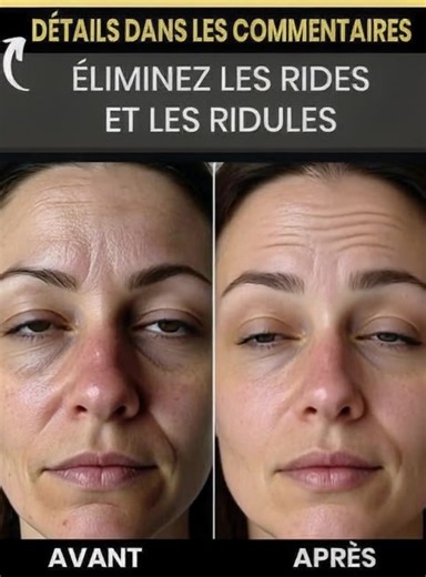 Secrets naturels pour une peau jeune et lisse : astuces maison pour combattre les signes de l’âge | Le monde des filles | Facebook