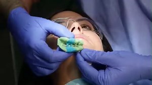 【Aquasil Ultra Plus】領先業界的抗撕裂強度 印模材料必須在從患者口腔中取出時具有足夠的強度，以抵抗撕裂。材料的高撕裂強度對於較薄區域，如備牙邊緣和鄰面間隙，尤其重要。我們獨家的專利技術能讓結構保持多官能基鍵結的狀態，使材料在最薄的橫截面積底下依然能保有一定的強度。讓您取模無煩惱! #新品上市活動開跑中 趕快把握機會搶先擁有吧!! #DentsplySirona #AquasilUltra #印模普拉斯 #Singleunitcrow | Dentsply Sirona