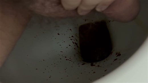 Diarrhea explosion - video 31