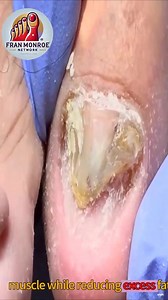 2.4K views · 14 reactions | Daily Habits That Support Help Women in Wellness Programs Maintain Healthy Toenails #trustedcare #footcare #agingwell | Fran Monroe | Facebook