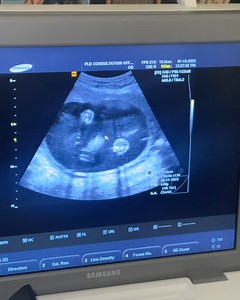 Today with the Lucas on Reels