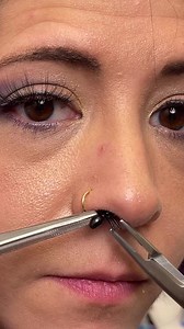 1.7M views · 4.6K reactions | He removed an insect from her nose!...