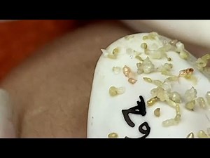 Satisfying With Loan Nguyen Spa Video #034